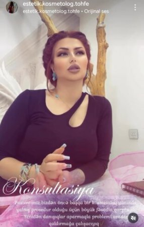 Estetik-kosmetoloq Töhfə Bayramova tibbi elminə verdiyi tohfələri: Seminarlarda iştirak edərək özünü doktor elan edib…..