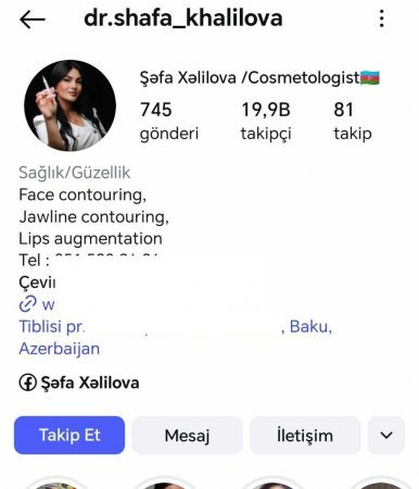 Şəfa Xəlilova dolğu,inyeksiya, botox prosedurlarını necə icra edir.? -