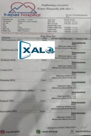“Kəpəz” Hospitalında narkotik istifadəçisi üçün analizlər necə təyin olunur?