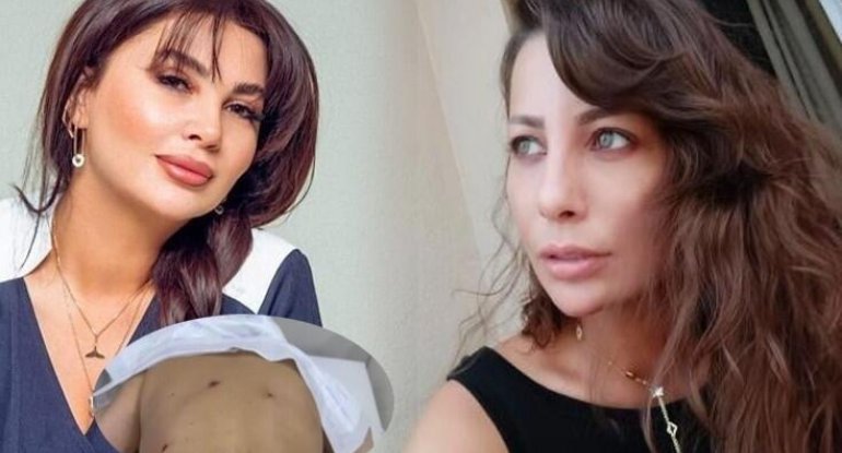 Aktrisaya görə Ülviyyə İlyasovanın cəzası artırıldı